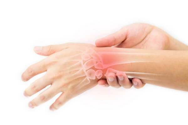 Sprained Wrist Injury: Causes, Treatment & Prevention